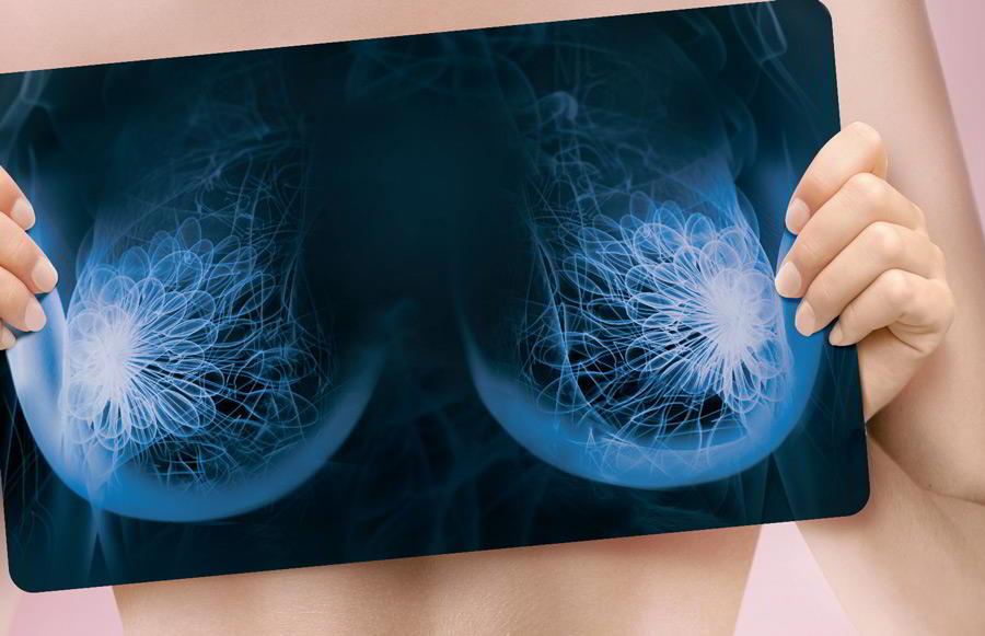 #ЯПРОШЛА: проходит масштабная акция против рака груди