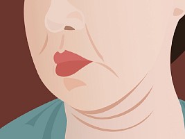 «Тяжелое лицо»: лучшие процедуры для лифтинга при отечно-деформационном типе старения