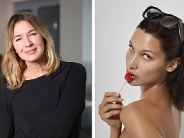 Шикарная работа: 5 звезд, у которых идеальная блефаропластика