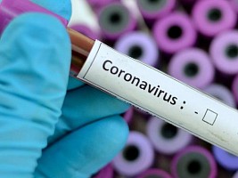 В России запускают тест-систему для определения иммунитета к коронавирусу