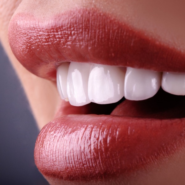 5. Уход после отбеливания