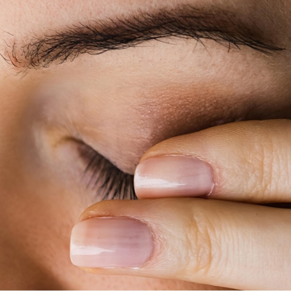 Выросло на глазах: ячмень или рак? 