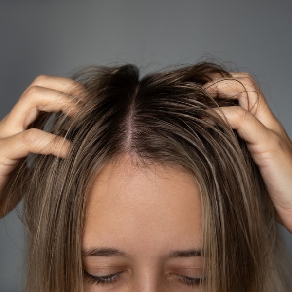 Почему волосы быстро становятся жирными и что с этим делать: объясняет трихолог