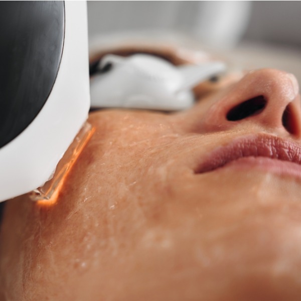 Можно ли делать фотоомоложение летом Можно ли делать фотоомоложение летом