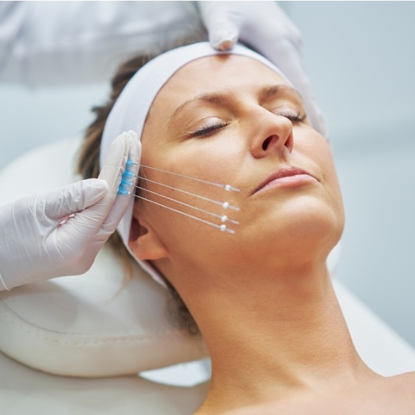 Механизм действия нитей: как именно формируется каркас и стимулируется коллаген?