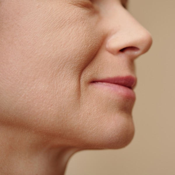 Топ процедур от носогубных складок Топ процедур от носогубных складок