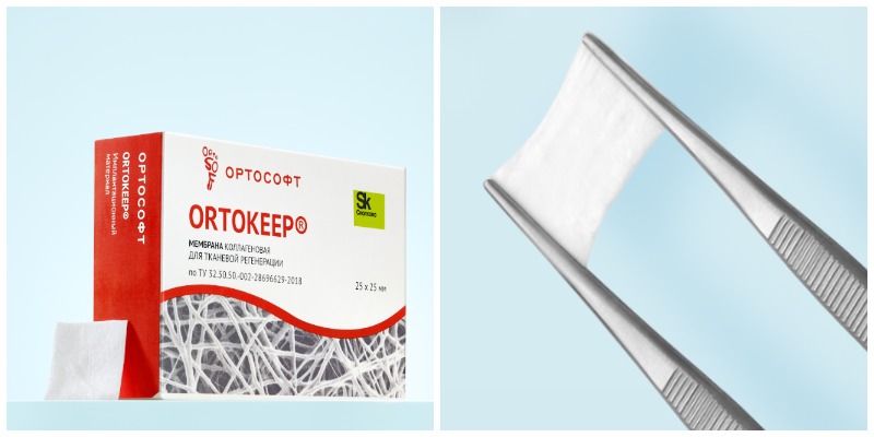 Мембрана Ортокип.jpg Мембрана Ортокип.jpg