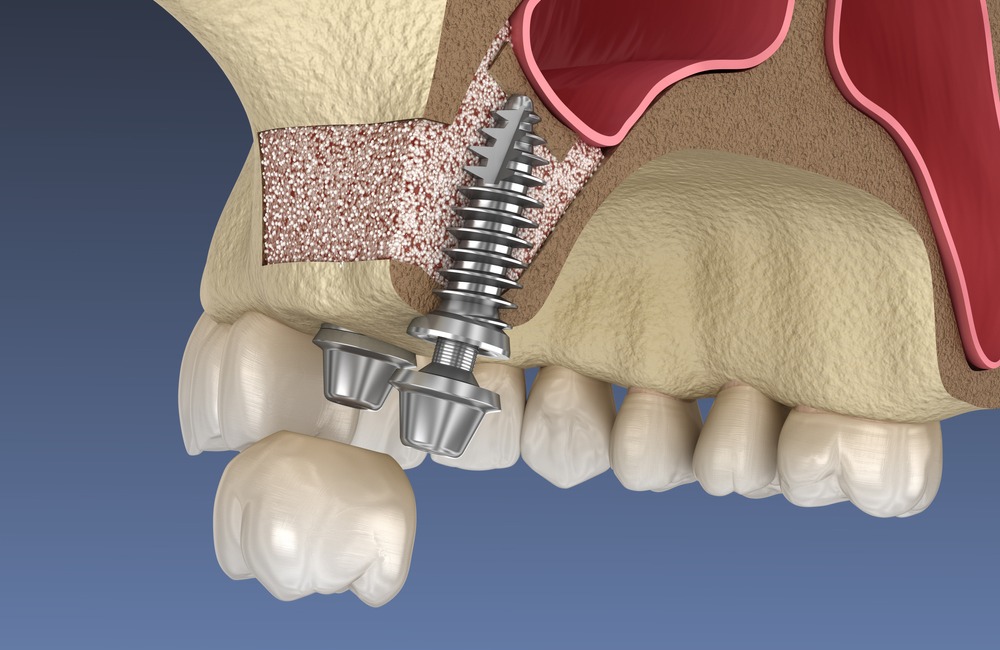 MyCollages - 2025-12-17T110452.640.jpg MyCollages - 2025-12-17T110452.640.jpg