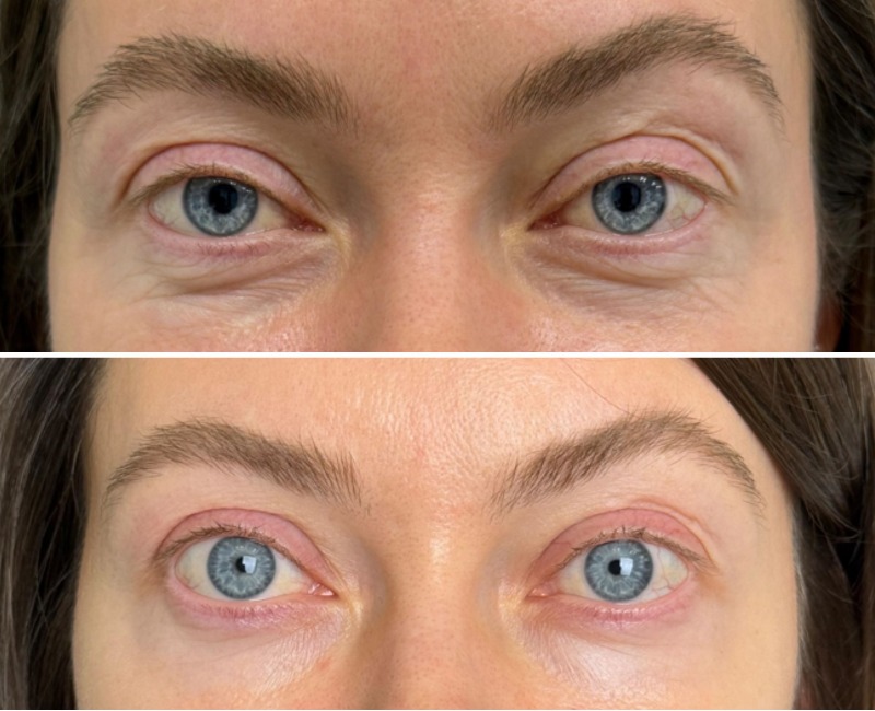 MyCollages - 2025-11-05T101016.710.jpg