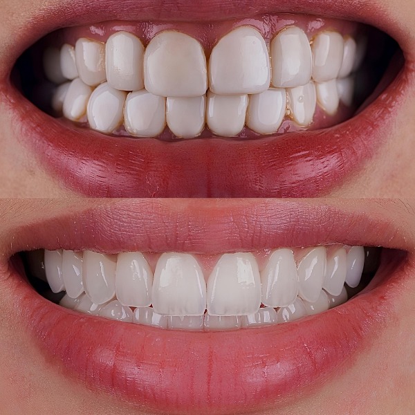 MyCollages - 2026-04-15T143617.938.jpg