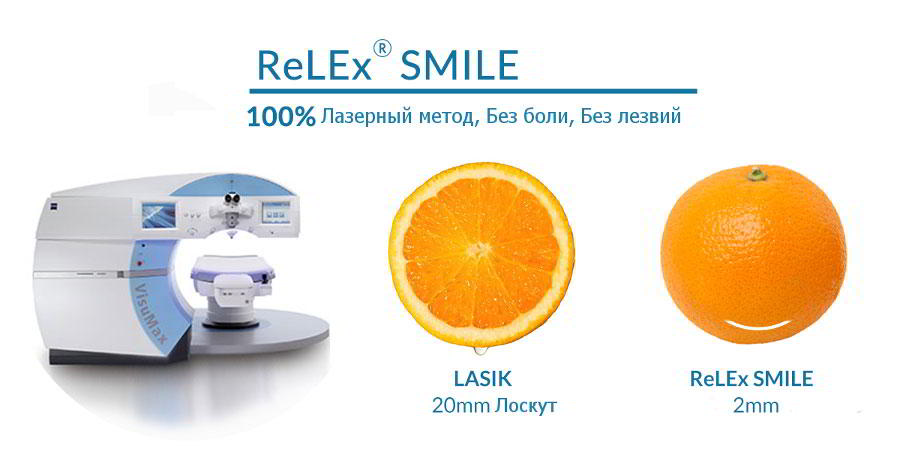 Лучший метод лазерной коррекции зрения ReLEx SMILE.jpg kiz-1-smile-vs-lasik.jpg