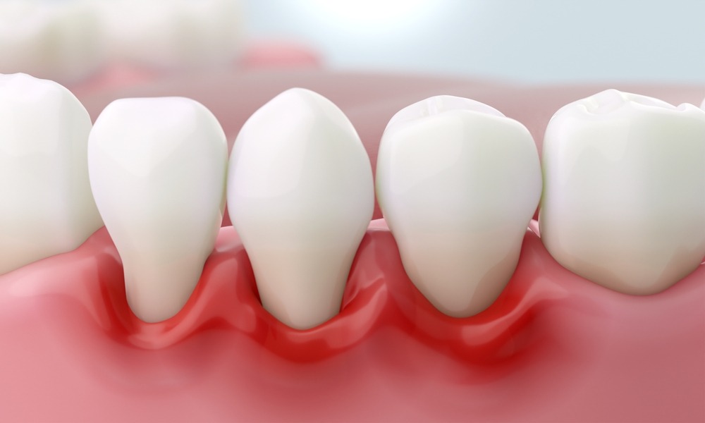 MyCollages - 2026-04-03T200512.109.jpg