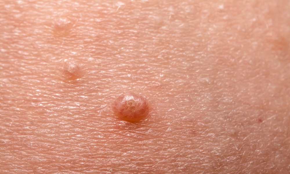 MyCollages - 2026-01-29T134741.646.jpg