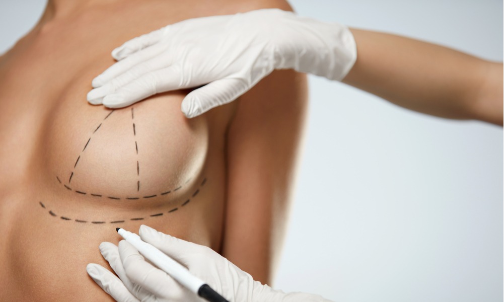 Две трети женщин не довольны формой своей груди: причины и решения