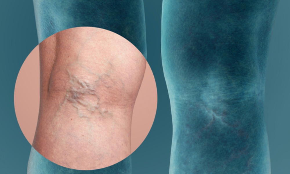 MyCollages - 2025-11-25T170949.311.jpg