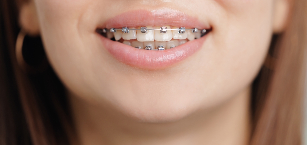 shutterstock_2703711501.jpg shutterstock_2703711501.jpg