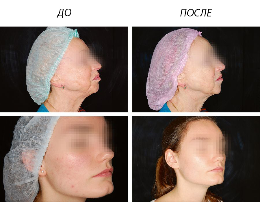1(2).jpg 1(2).jpg