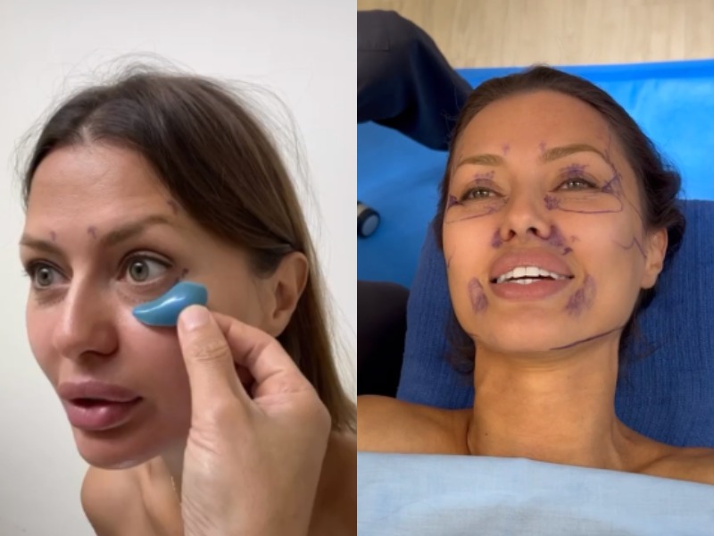 Дотянуть второй глаз»: Виктория Боня готовится к очередной пластической  операции