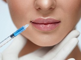 Через сколько рассасывается гиалуроновая кислота в губах: 6 ключевых факторов