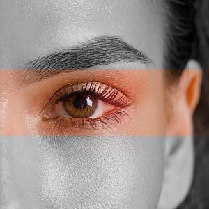 Лопнул сосуд в глазу: в каком случае нужно срочно идти к офтальмологу?