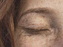 Дерматологи рассказали о преимуществах гликолевой кислоты для кожи лица