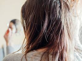 Волосы будто грязные: почему уход и укладка могут вредить здоровью кожи головы