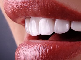 Актуальные вопросы об отбеливании зубов