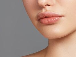 Гиалуроновые усы: почему над губой появляется некрасивый контур и как этого можно избежать