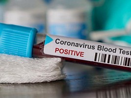 Китайские ученые: плазма переболевших коронавирусом может оказаться бесполезной
