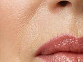 У себя под носом: 7 способов устранения морщин над верхней губой