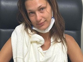«Закроем эту тему»: почему пользователи Сети не верят, что Белла Хадид страдает болезнью Лайма