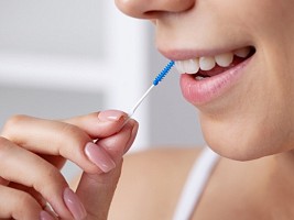 Межзубные ершики: как правильно их подбирать?