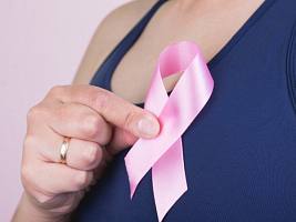 Грудь вернуть: что нужно знать о реконструктивной маммопластике