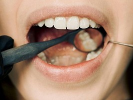 Беременность и лечение зубов: что можно и нельзя 