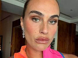 «Моя кожа сильно повреждена солнцем»: теннисистка Арина Соболенко возит на турниры 4,5 кг косметики