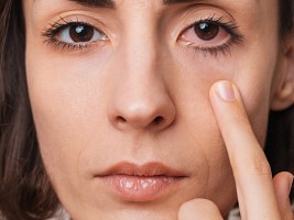 Сон в контактных линзах: стоит ли рисковать?