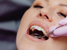 Скрипя зубами: что такое бруксизм и как его лечить