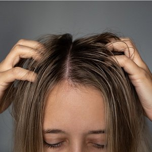 Почему волосы быстро становятся жирными и что с этим делать: объясняет трихолог