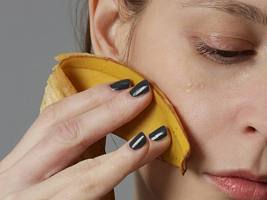 Банановая кожура вместо ботокса: эффективен ли нашумевший бьюти-тренд
