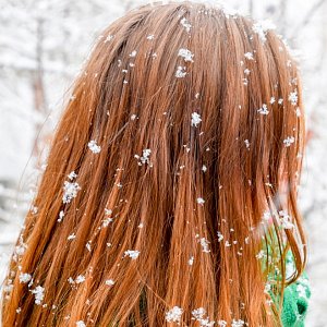 Пусть снег будет на улице, а не на голове: как избавиться от сухости кожи головы зимой