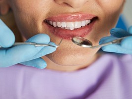 Улыбка выдает: почему зубы могут прибавить лицу лишние годы и как этого избежать