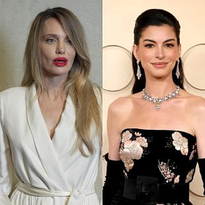 Анджелина Джоли, Меган Фокс, Энн Хэтэуэй: 5 звезд, которых заподозрили в пластике в 2026 году