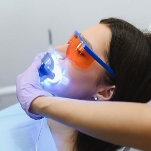 Правда ли, что отбеливание портит эмаль? Честный разбор всех сомнений от стоматолога