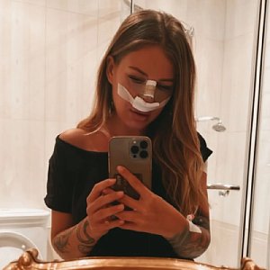 «Тот еще квест»: с какими проблемами столкнулась Рита Дакота после ринопластики «Тот еще квест»: с какими проблемами столкнулась Рита Дакота после ринопластики