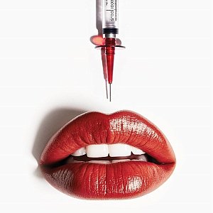 Удачная комбинация: в чем плюсы нового препарата Regenyal Idea Super Lips
