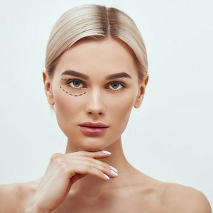 Безоперационная блефаропластика