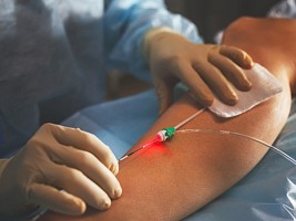 Эстетическая флебология: какие современные методы помогают устранить проявление варикоза на ногах