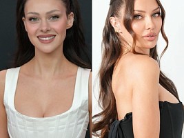 Никола Пельтц, Виктория Боня, Кортни Кардашьян: кто из звезд делал инъекции коллагена