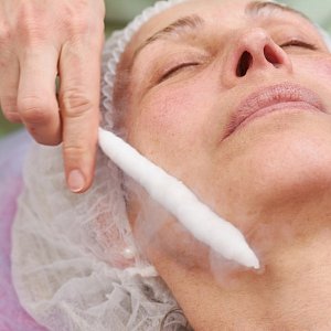 Криотерапия лица