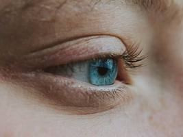 3 вопроса о коррекции зоны вокруг глаз, ответы на которые вы не знаете